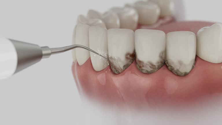 Trusted Tooth Extraction service in Richmond Hill, GA - Dentist Open Now